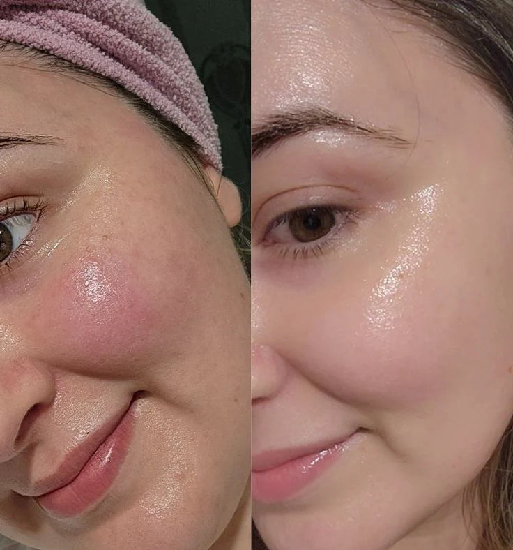 "This turned my dry, tight skin into glass in one hour. Instant hydration. Unreal glow.".